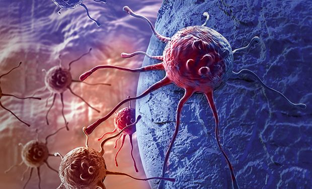 UKRI’s MRC invests £2m for hard-to-treat cancers