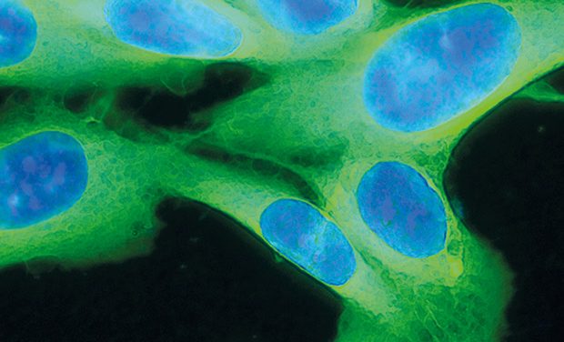 UCL study reveals routine blood tests could improve early cancer diagnosis