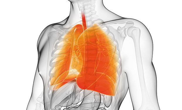 FDA grants fast-track designation for Istesso’s IPF candidate