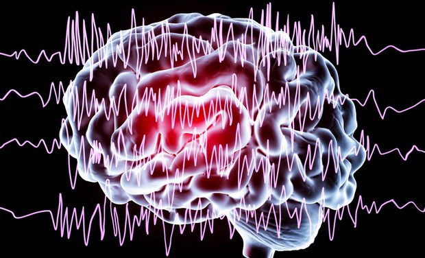 NHS to roll out fibre optic laser therapy to prevent seizures in epileptic patients