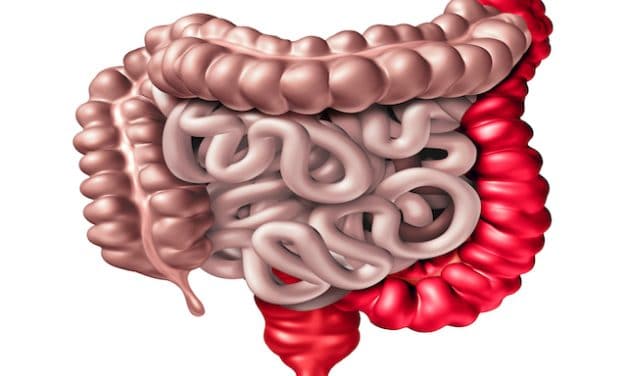 ETH Zurich researchers reveal how colorectal cancer cells colonise the liver